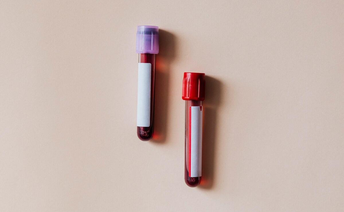 Blood test tubes on a beige surface