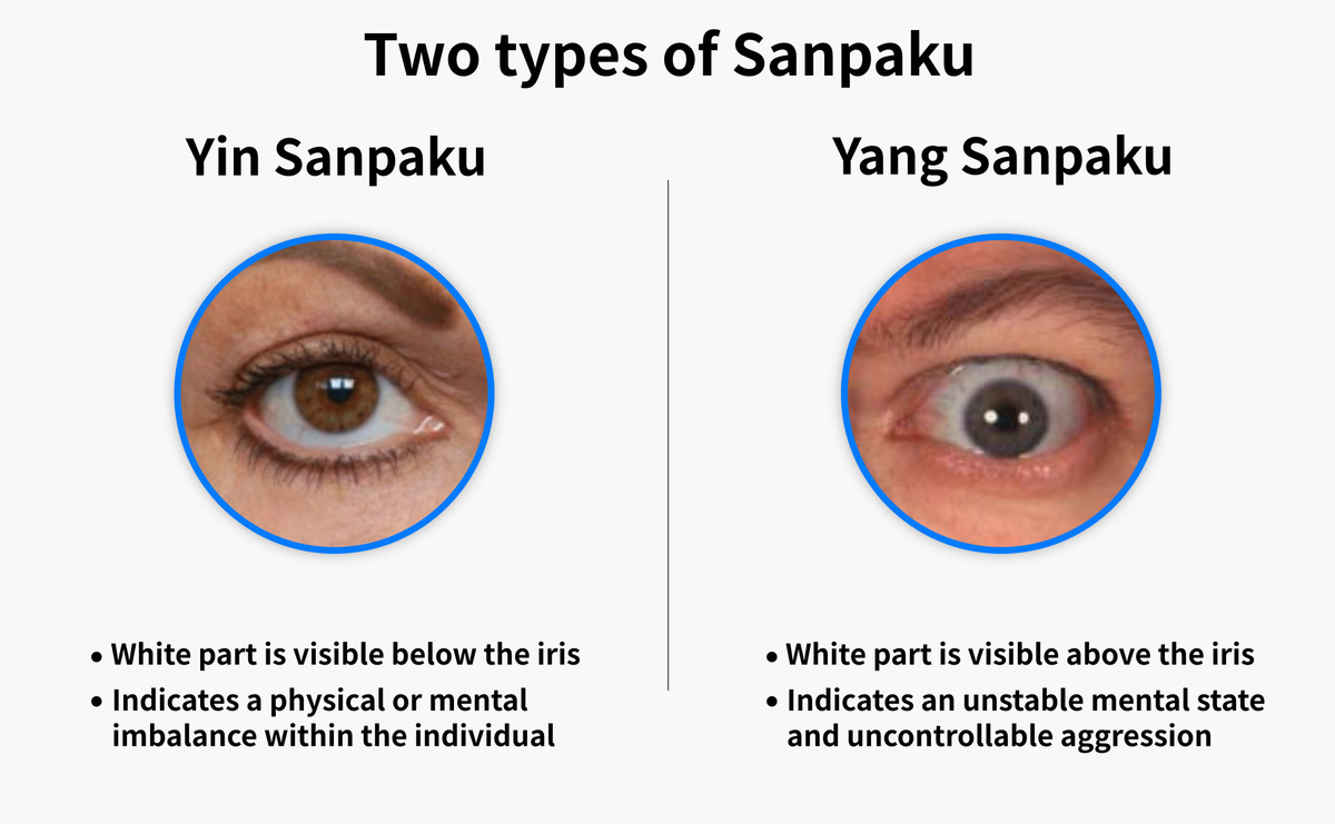 Illustrating the difference between yin and yan sanpaku eyes.