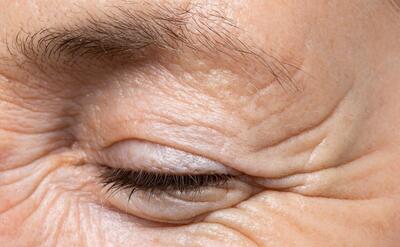 Side view senior woman skin texture